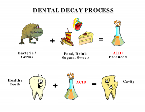 dental decay process