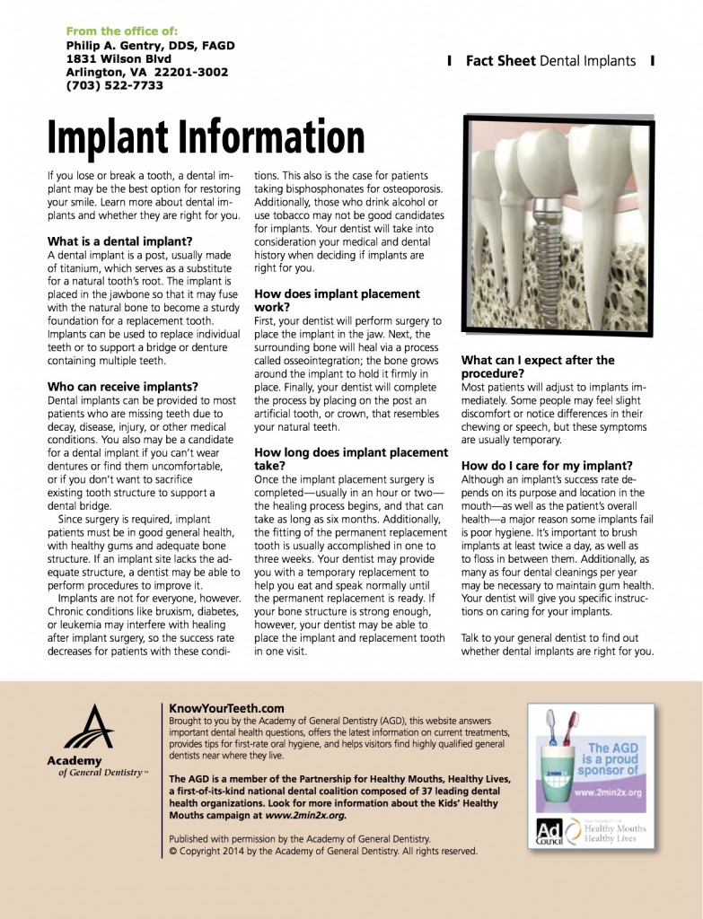 implantfactsheet