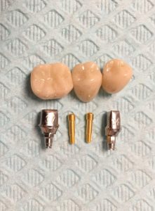 dental implant parts