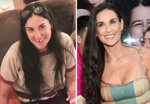 demimoore-before after