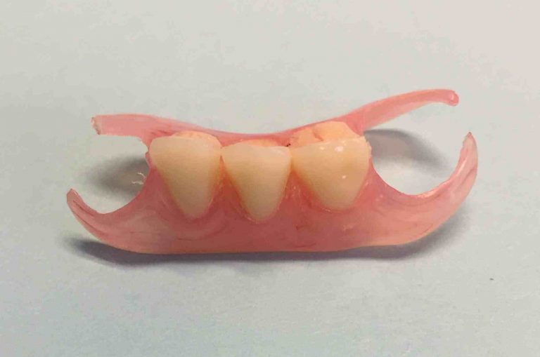 Nhs Partial Denture Repair